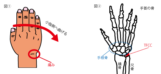 手首 の 外側 が 痛い