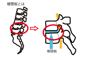 椎間板　説明