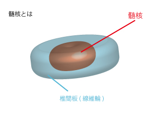 髄核とは