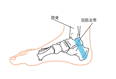 足根管症候群