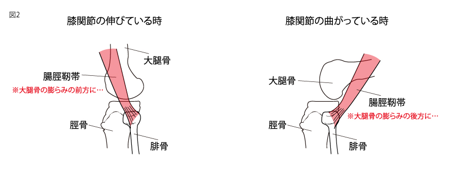 腸脛靭帯２