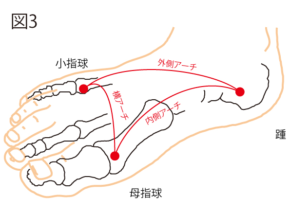 モートン病３