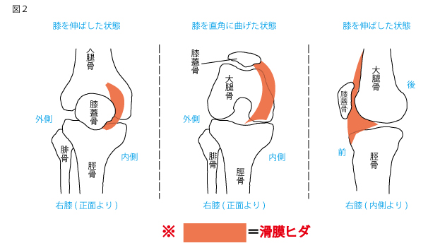 ひだ 障害 膜 滑 タナ障害(滑膜ひだ障害)｜大野城 交通事故治療は【ゆうひ整骨院】