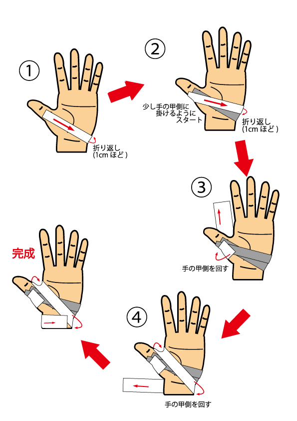 テーピング 親指 骨折