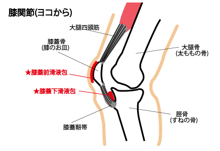 膝蓋前滑液包炎 お皿の上が腫れる やすらぎ整骨院 長岡京市